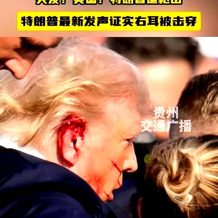 7月10日, 特朗普介入！巴洛贡禁赛缓期，克洛普怒批